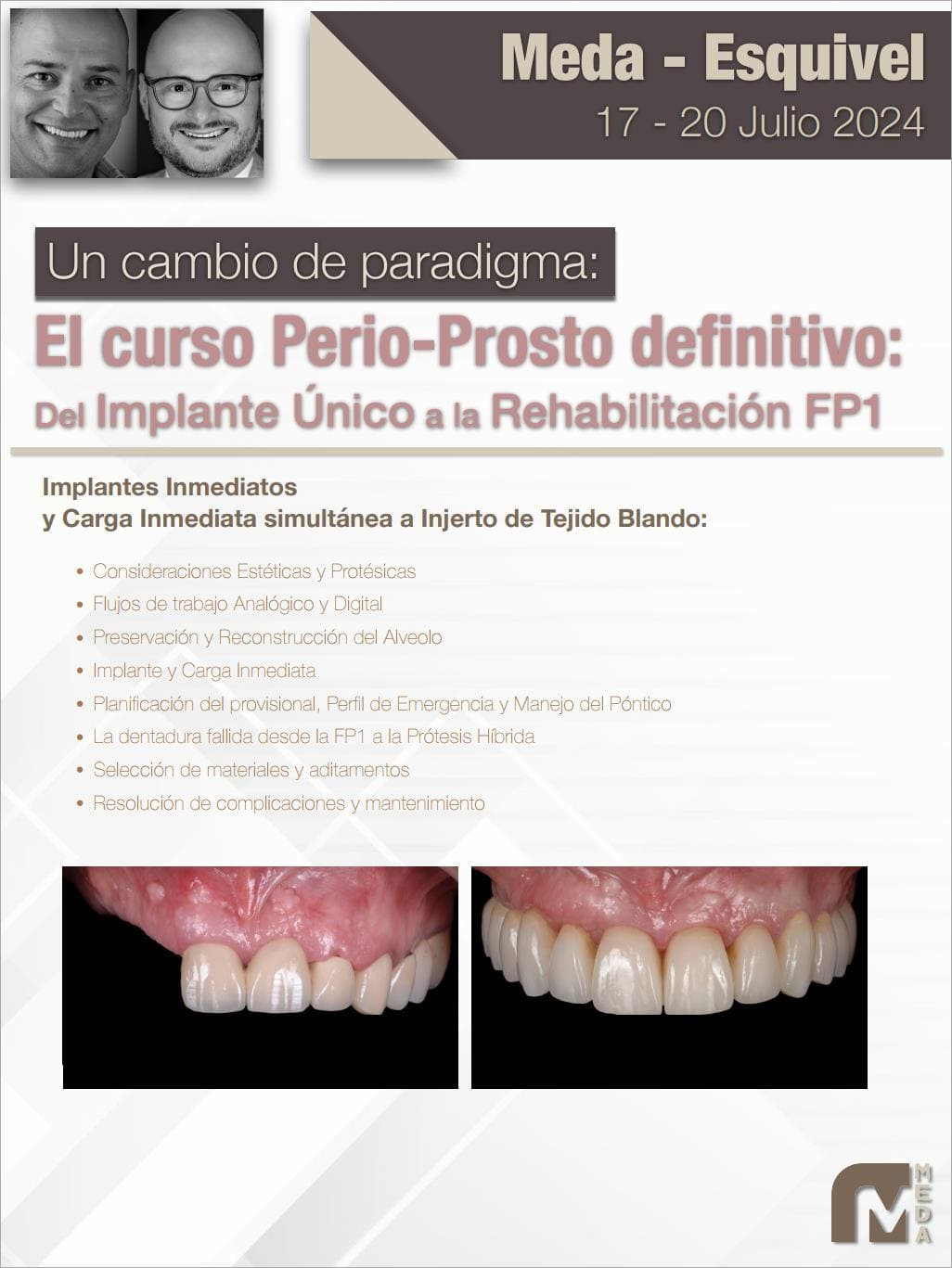 Curso Perio-Prosto Definitivo en Meda Dental Academy edición 2024